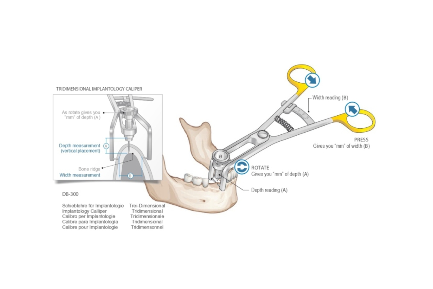 Osteometer